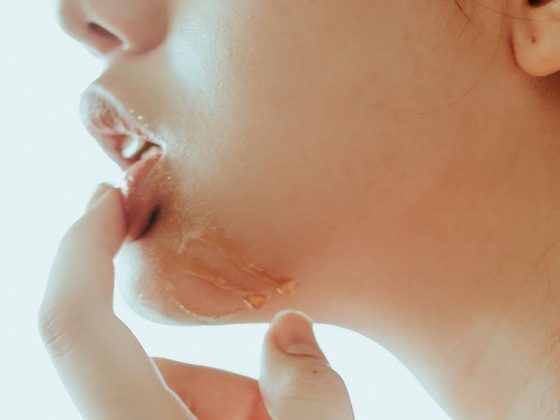 7 Petua Semula Jadi Mencerahkan Bibir Gelap Dan Kusam Dalam Masa Seminggu