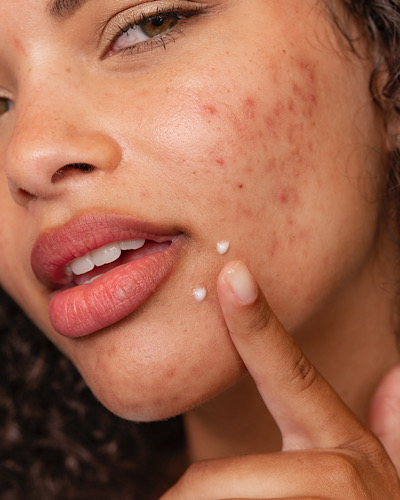 SKinCare