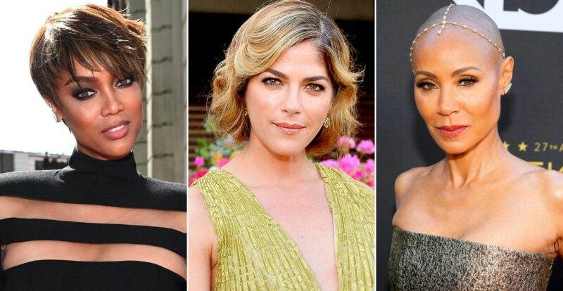 Selebriti Popular Hollywood Yang Bergelut Dengan Alopecia