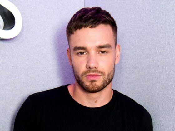 Transformasi Dramatik Liam Payne Mengundang Tanda Tanya Peminat