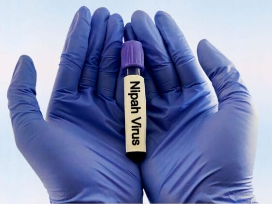 Apa Itu Virus Nipah & Mengapa Ia Berbahaya?