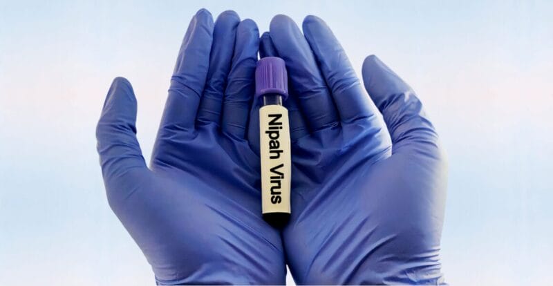 Apa Itu Virus Nipah & Mengapa Ia Berbahaya?